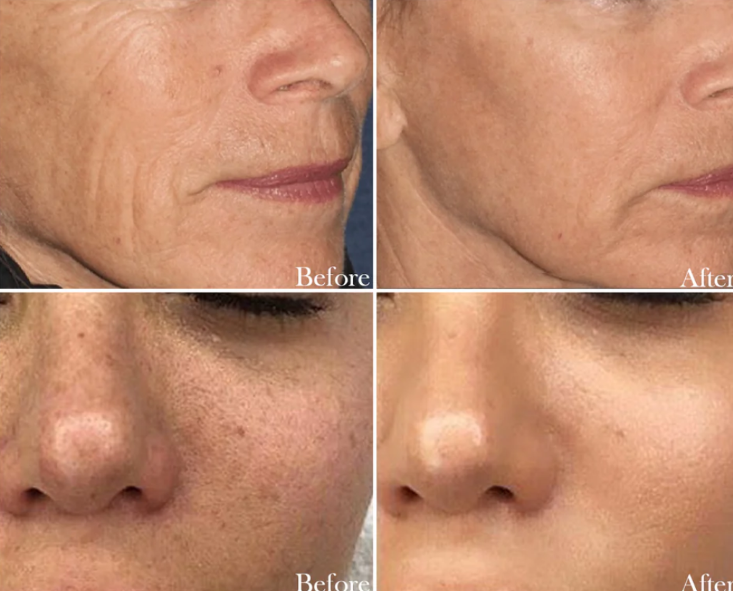 Face Yoga Age-Reversing Saffron Serum
