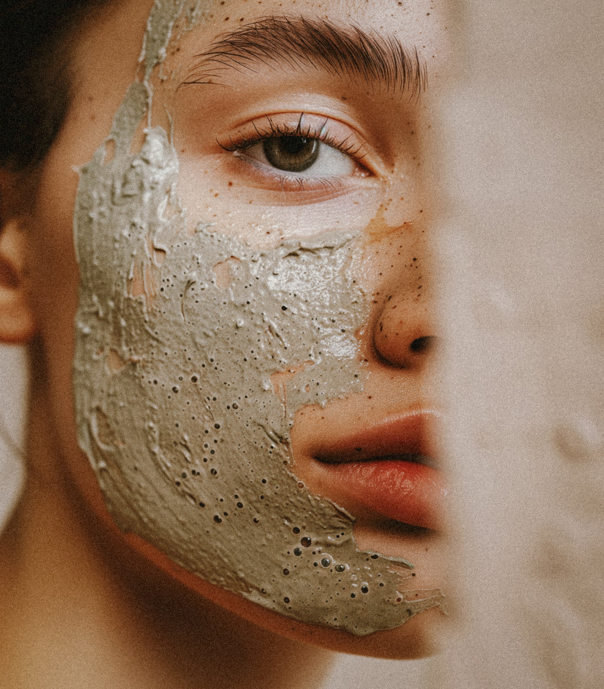 Ayurvedic Remedies for Acne: Natural Solutions for Clear Skin – Vayu Living